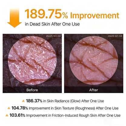 🌸 New! LOVILDS® Peeling Shot Keratin Care Kojic Acid Turmeric Spray